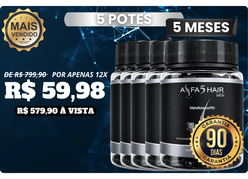 Kit Alfa5Hair Men